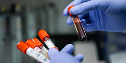 Gloved hands holding several bottles of blood ampoules